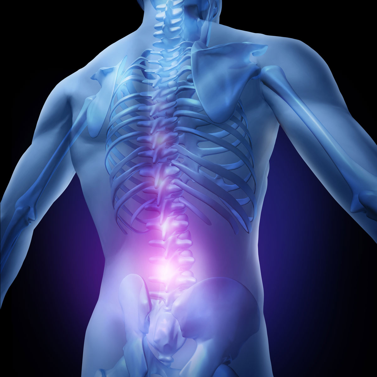 Recurrent Low Back Pain