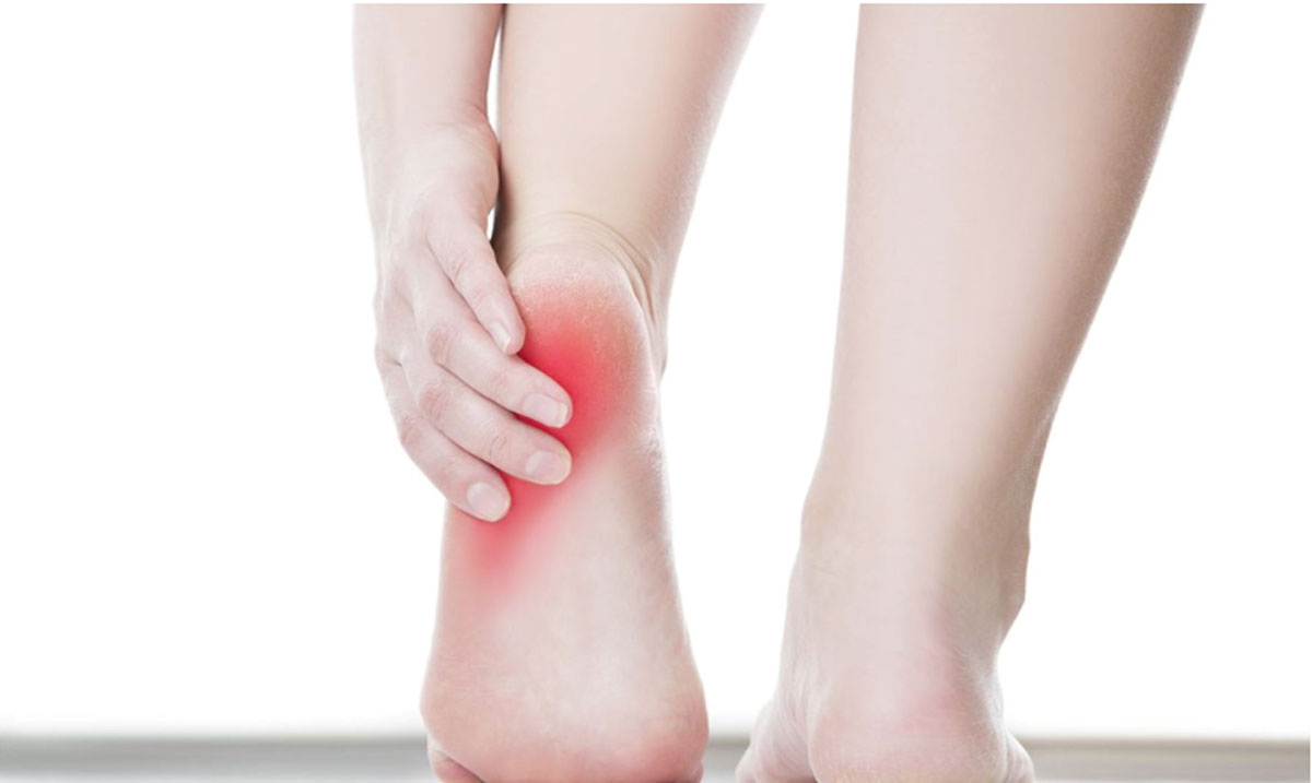 Plantar Fasciitis