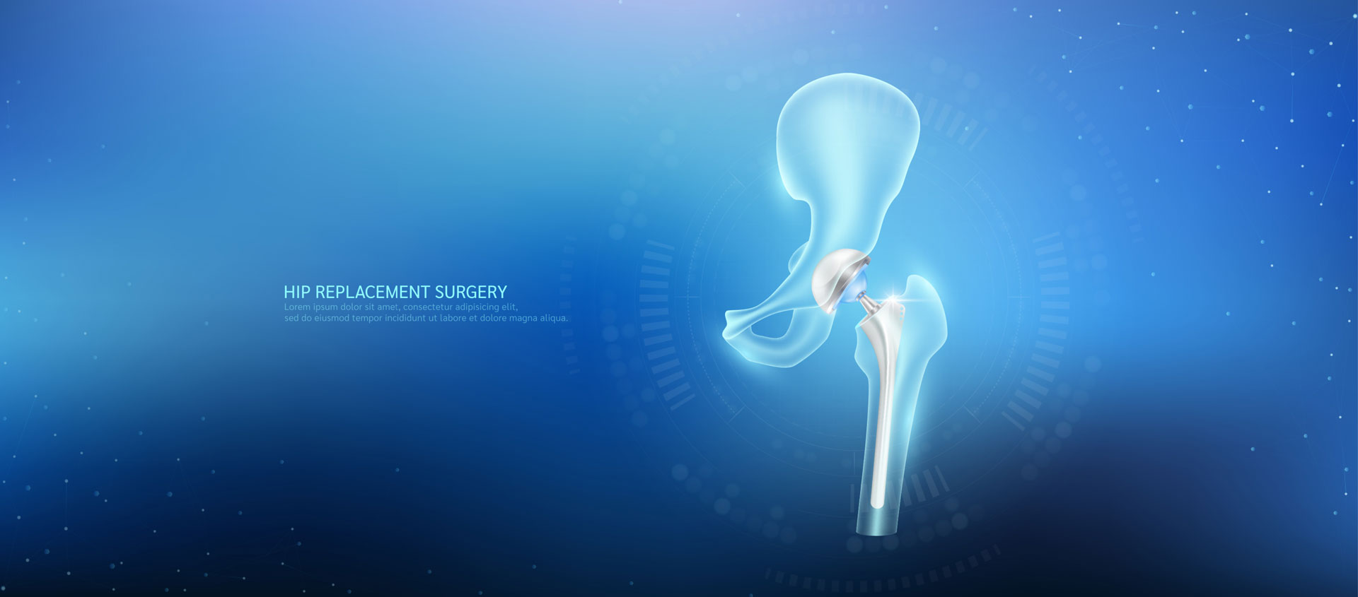 Pre/Post Hip/Knee arthroplasty